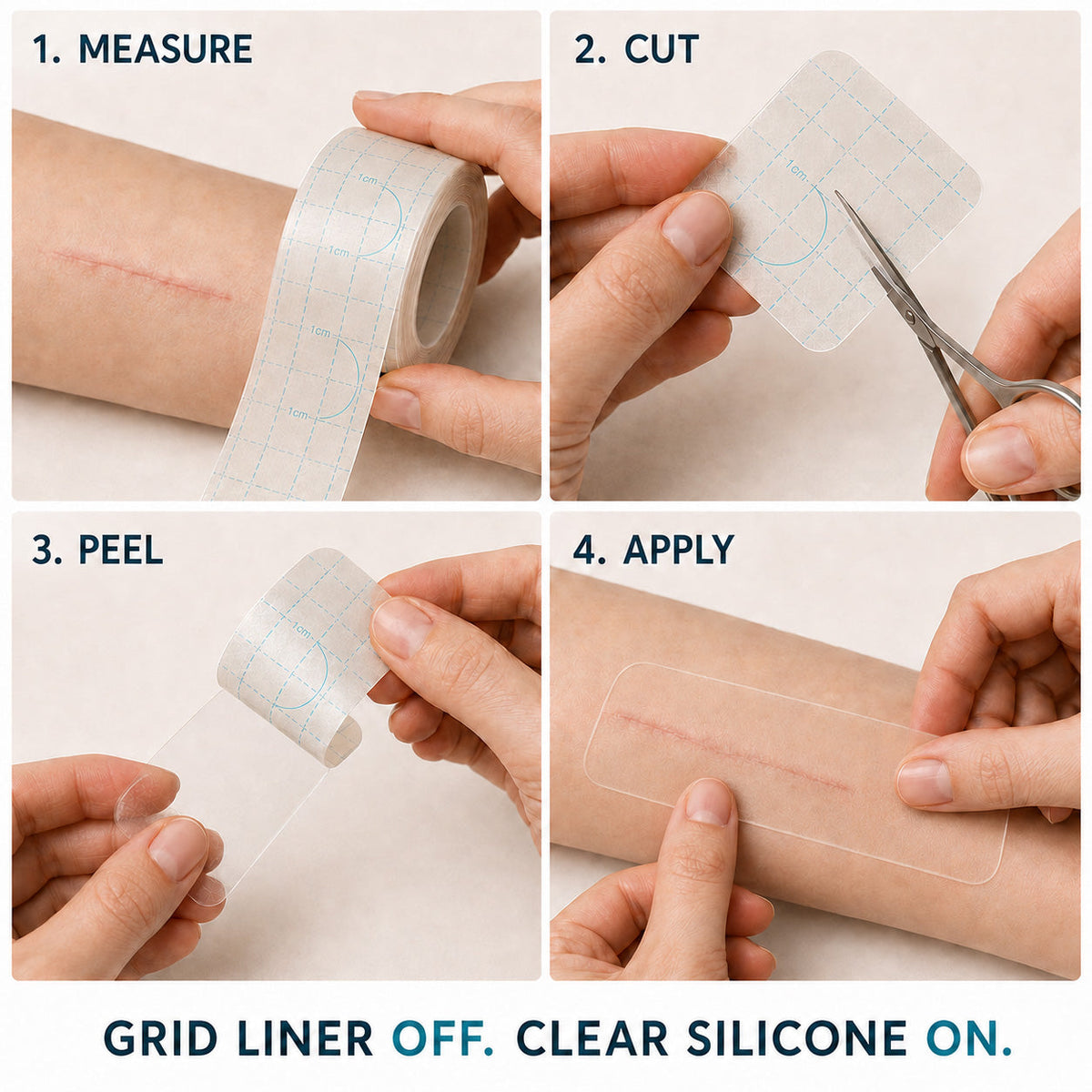 🥕Trilumia® Silicone Scar Therapy Roll — Custom-Fit Care for Long, Raised Surgical Scars