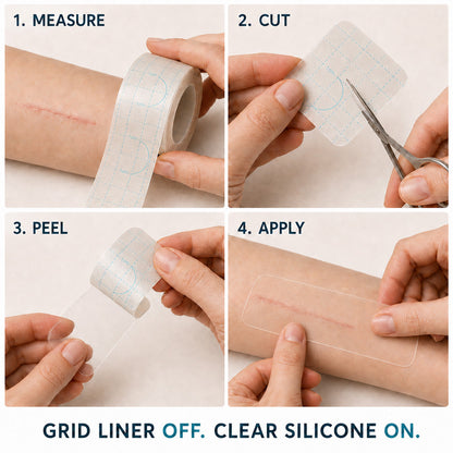 🥕Trilumia® Silicone Scar Therapy Roll — Custom-Fit Care for Long, Raised Surgical Scars