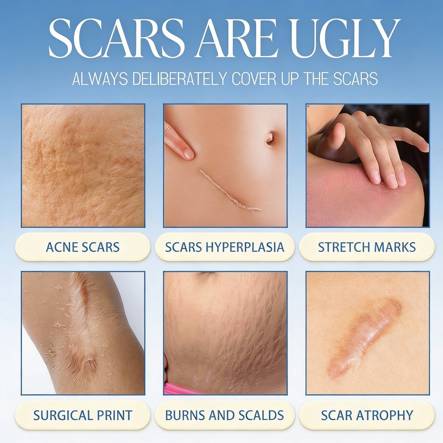🔥𝑶𝒇𝒇𝒊𝒄𝒊𝒂𝒍 𝑺𝒕𝒐𝒓𝒆 |Scar Removal Cream — Restore Skin & Regain Confidence🌹