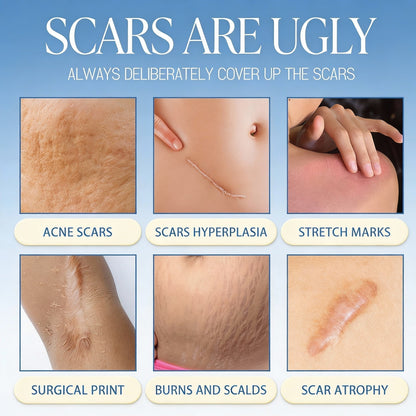 🔥𝑶𝒇𝒇𝒊𝒄𝒊𝒂𝒍 𝑺𝒕𝒐𝒓𝒆 |Scar Removal Cream — Restore Skin & Regain Confidence🌹