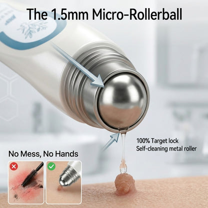 Official Store⚓𝙹𝘰ᴜs 7-𝐷𝑎𝑦 𝗧𝐚𝐠 & 𝗦𝗽𝐨𝐭 𝐄𝐫𝒂𝒔𝒆𝒓(Zero Pain, Zero 𝐒𝐜𝐚𝒓𝒔 Rollerball)