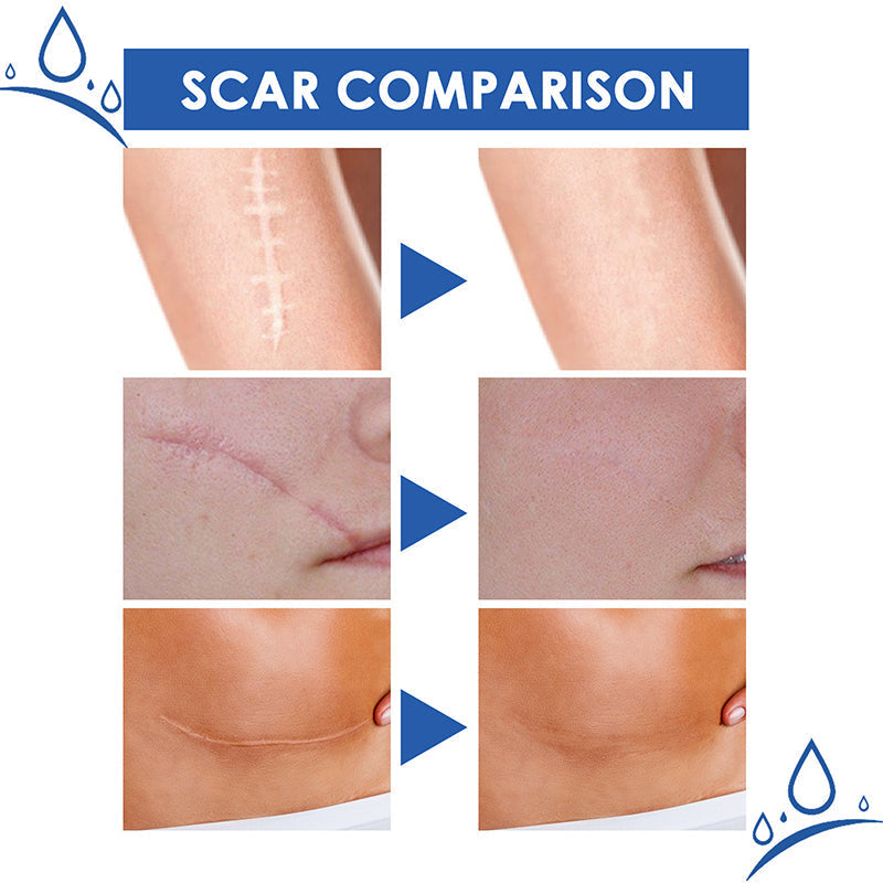 🔥𝑶𝒇𝒇𝒊𝒄𝒊𝒂𝒍 𝑺𝒕𝒐𝒓𝒆 |Scar Removal Cream — Restore Skin & Regain Confidence🌹