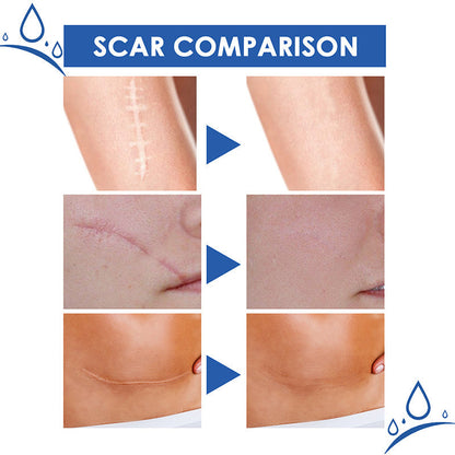 🔥𝑶𝒇𝒇𝒊𝒄𝒊𝒂𝒍 𝑺𝒕𝒐𝒓𝒆 |Scar Removal Cream — Restore Skin & Regain Confidence🌹